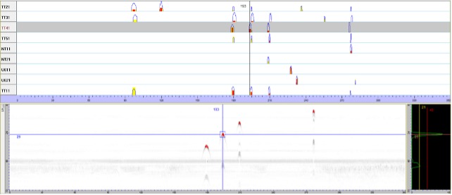 Snímek obrazovky zobrazení dat včetně výsledků A-skenu a B-skenu pro ultrazvukovou kontrolu železničního dvojkolí 